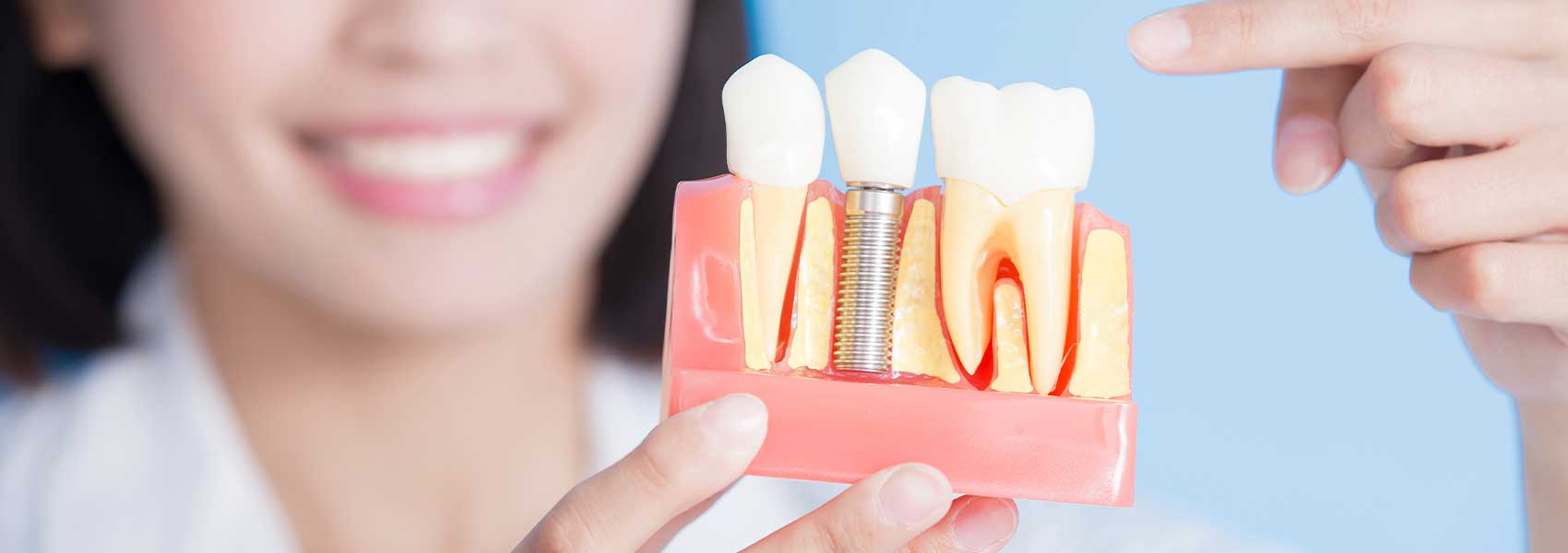 A lady dentist holding on a prototype of dental implant